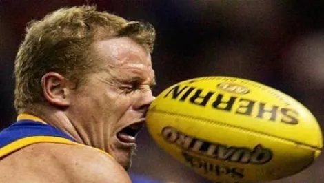 Rugby can be painful